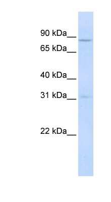 Western Blot: POMT1 Antibody [NBP1-60054]