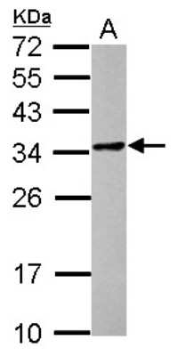 Western Blot: POMZP3 Antibody [NBP2-19892]