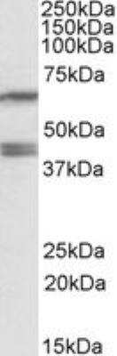 Western Blot: PON2 Antibody [NBP1-52005]