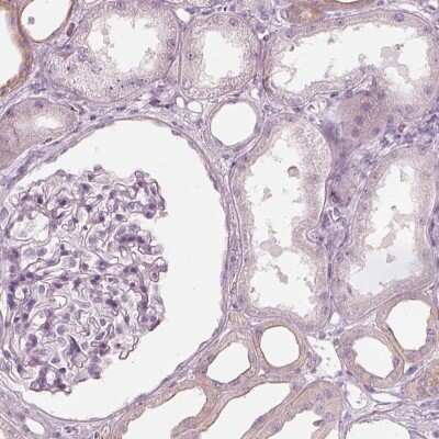 Immunohistochemistry-Paraffin: PON3 Antibody [NBP1-86074]