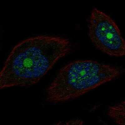 Immunocytochemistry/ Immunofluorescence: POP1 Antibody [NBP2-68837]
