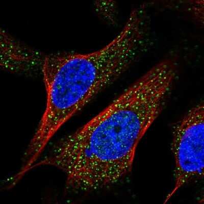 Immunocytochemistry/ Immunofluorescence: POP7 Antibody [NBP1-92282]