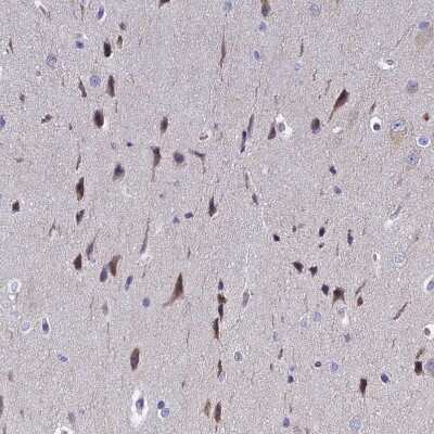 Immunohistochemistry-Paraffin: POP7 Antibody [NBP1-92282]