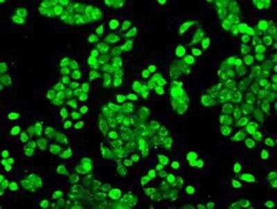 Immunocytochemistry/ Immunofluorescence: POR/Cytochrome P450 Reductase Antibody (OTI3F10) [NBP1-47914]