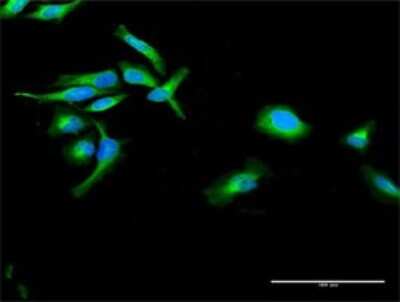 Immunocytochemistry/ Immunofluorescence: POR/Cytochrome P450 Reductase Antibody [H00005447-D01P]