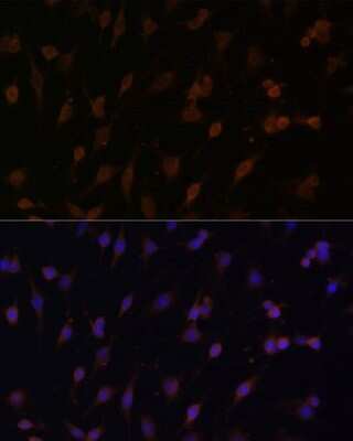 Immunocytochemistry/ Immunofluorescence: POR/Cytochrome P450 Reductase Antibody - BSA Free [NBP3-03396]