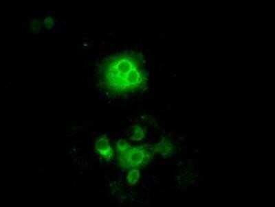 Immunocytochemistry/ Immunofluorescence: POR/Cytochrome P450 Reductase Antibody (OTI3F10) - Azide and BSA Free [NBP2-73539]