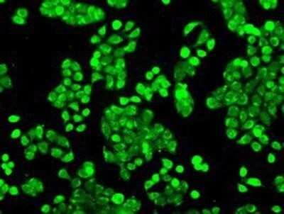 Immunocytochemistry/ Immunofluorescence: POR/Cytochrome P450 Reductase Antibody (OTI3F10) - Azide and BSA Free [NBP2-73539]