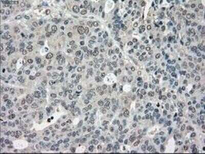 Immunohistochemistry: POR/Cytochrome P450 Reductase Antibody (OTI3F10) - Azide and BSA Free [NBP2-73539]