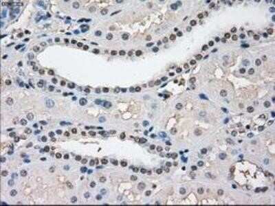 Immunohistochemistry: POR/Cytochrome P450 Reductase Antibody (OTI3F10) - Azide and BSA Free [NBP2-73539]