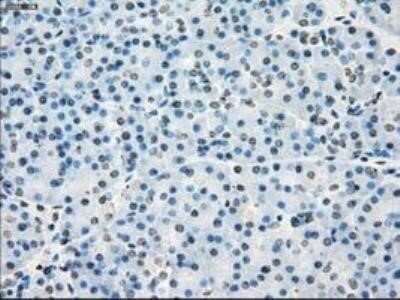Immunohistochemistry: POR/Cytochrome P450 Reductase Antibody (OTI3F10) - Azide and BSA Free [NBP2-73539]