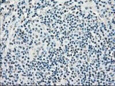 Immunohistochemistry: POR/Cytochrome P450 Reductase Antibody (OTI3F10) - Azide and BSA Free [NBP2-73539]