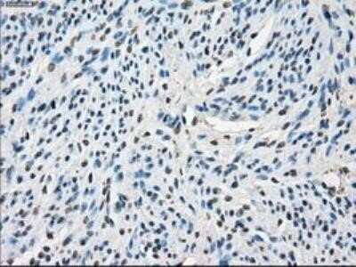 Immunohistochemistry: POR/Cytochrome P450 Reductase Antibody (OTI3F10) - Azide and BSA Free [NBP2-73539]