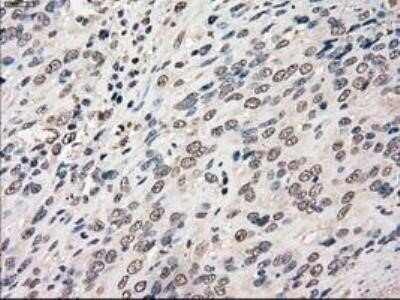 Immunohistochemistry: POR/Cytochrome P450 Reductase Antibody (OTI3F10) - Azide and BSA Free [NBP2-73539]