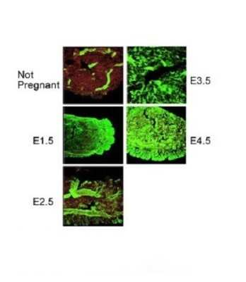 Immunohistochemistry: PORCN Antibody [NBP1-59677]
