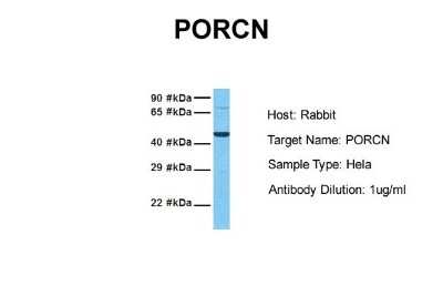 Western Blot: PORCN Antibody [NBP1-59677]