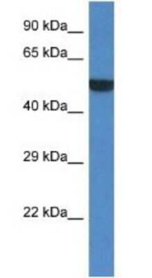Western Blot: PORCN Antibody [NBP1-79322]