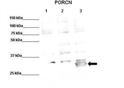 Western Blot: PORCN Antibody [NBP1-79322]