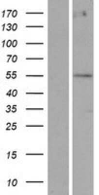 Western Blot: POTEA Overexpression Lysate [NBP2-08856]