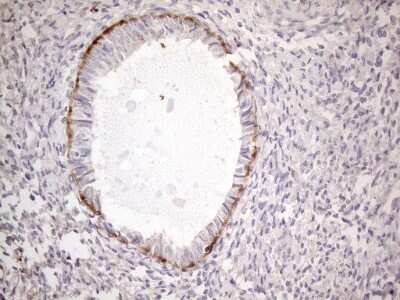 Immunohistochemistry: POTEG Antibody (OTI2G1) [NBP2-45372]