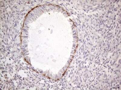 Immunohistochemistry: POTEG Antibody (OTI2G1) - Azide and BSA Free [NBP2-73540]