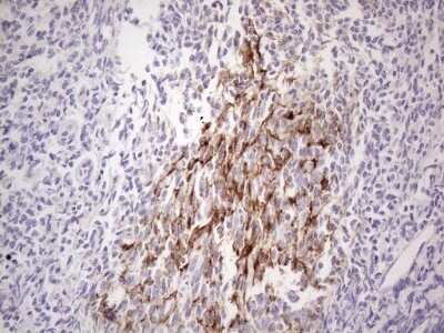 Immunohistochemistry: POTEG Antibody (OTI2G1) - Azide and BSA Free [NBP2-73540]
