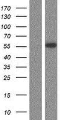 Western Blot: OCT2 Overexpression Lysate [NBP2-10845]