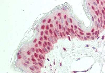 Immunohistochemistry-Paraffin: POU2F3 Antibody [NBP2-88074]