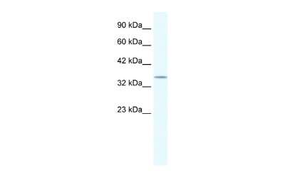 Western Blot: POU2F3 Antibody [NBP2-88075]