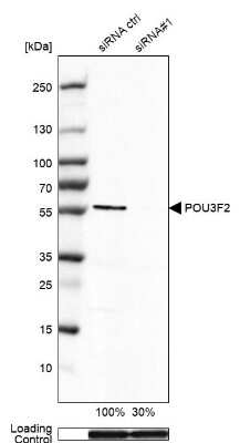Western Blot: POU3F2/OCT7 Antibody (CL6228) [NBP2-61436]