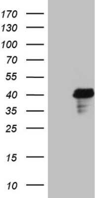 Western Blot: POU4F3 Antibody (OTI4C5) [NBP2-45375]