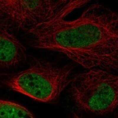 Immunocytochemistry/ Immunofluorescence: POU5F2 Antibody [NBP3-17294]