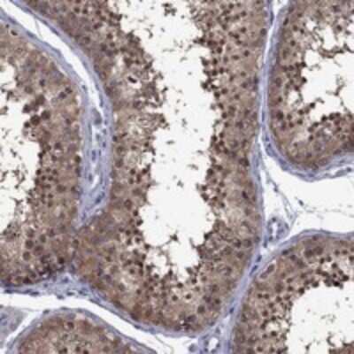 Immunohistochemistry-Paraffin: POU5F2 Antibody [NBP3-17294]