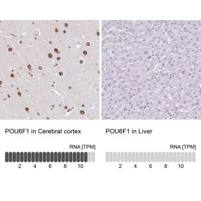 Immunohistochemistry-Paraffin: POU6F1 Antibody [NBP2-13791]