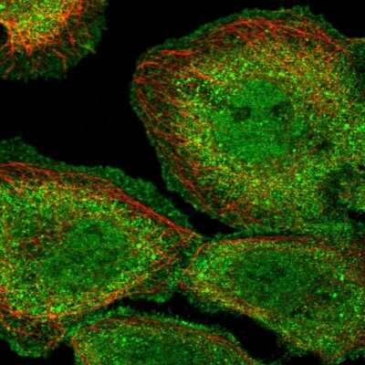 Immunocytochemistry/ Immunofluorescence: PP1 alpha/PPP1A Antibody [NBP2-38559]