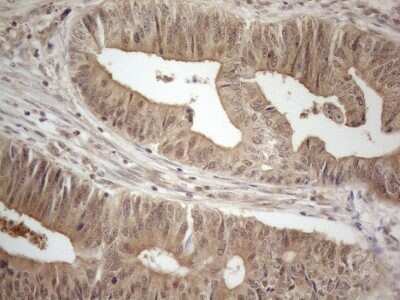 Immunohistochemistry-Paraffin: PP1 alpha/PPP1A Antibody (OTI6E5) [NBP2-45384]