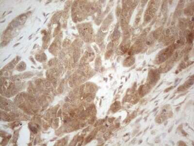 Immunohistochemistry-Paraffin: PP1 alpha/PPP1A Antibody (OTI6E5) [NBP2-45384]