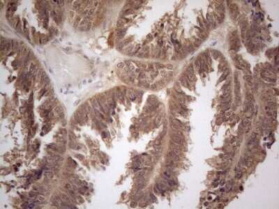 Immunohistochemistry-Paraffin: PP1 alpha/PPP1A Antibody (OTI6E5) [NBP2-45384]