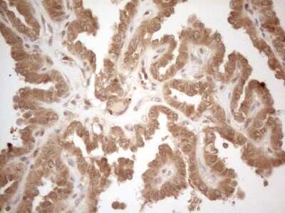 Immunohistochemistry-Paraffin: PP1 alpha/PPP1A Antibody (OTI6E5) [NBP2-45384]