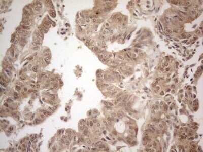 Immunohistochemistry-Paraffin: PP1 alpha/PPP1A Antibody (OTI6E5) [NBP2-45384]