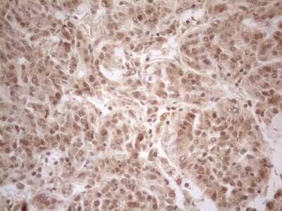 Immunohistochemistry-Paraffin: PP1 alpha/PPP1A Antibody (OTI6E5) [NBP2-45384]