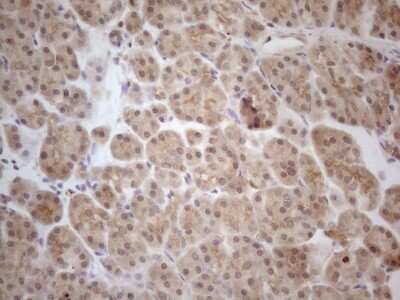 Immunohistochemistry-Paraffin: PP1 alpha/PPP1A Antibody (OTI6E5) [NBP2-45384]