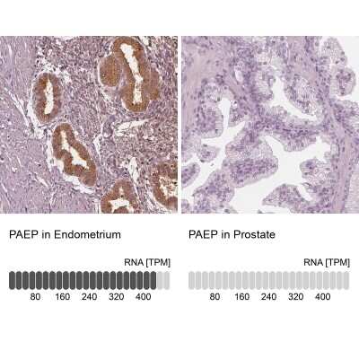 Immunohistochemistry-Paraffin: PP14/Glycodelin Antibody [NBP1-89781]