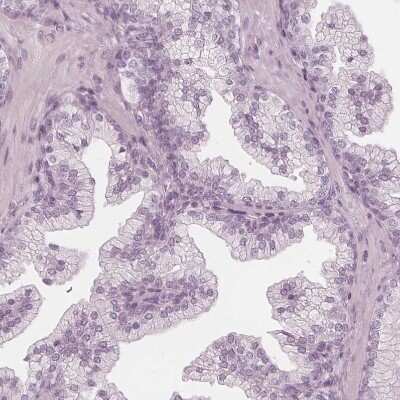 Immunohistochemistry-Paraffin: PP14/Glycodelin Antibody [NBP1-89781]