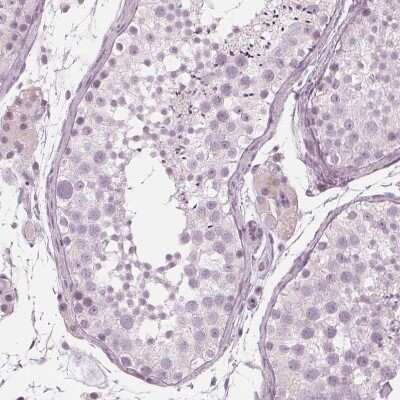 Immunohistochemistry-Paraffin: PP14/Glycodelin Antibody [NBP1-89781]