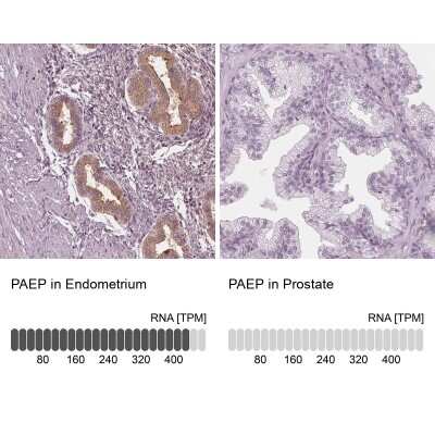 Immunohistochemistry-Paraffin: PP14/Glycodelin Antibody [NBP1-89782]
