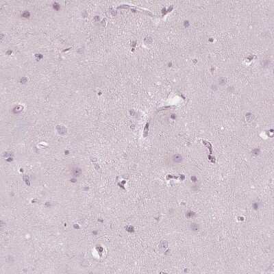 Immunohistochemistry-Paraffin: PP14/Glycodelin Antibody [NBP1-89782]