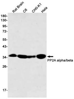 Western Blot: PP2A alpha/beta Antibody (S04-4G4) [NBP3-15081]