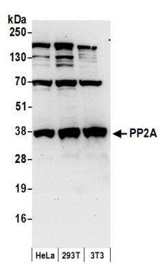 Western Blot: PP2A alpha Antibody [NB100-2260]