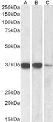 Western Blot: PP2A alpha Antibody [NB100-844]